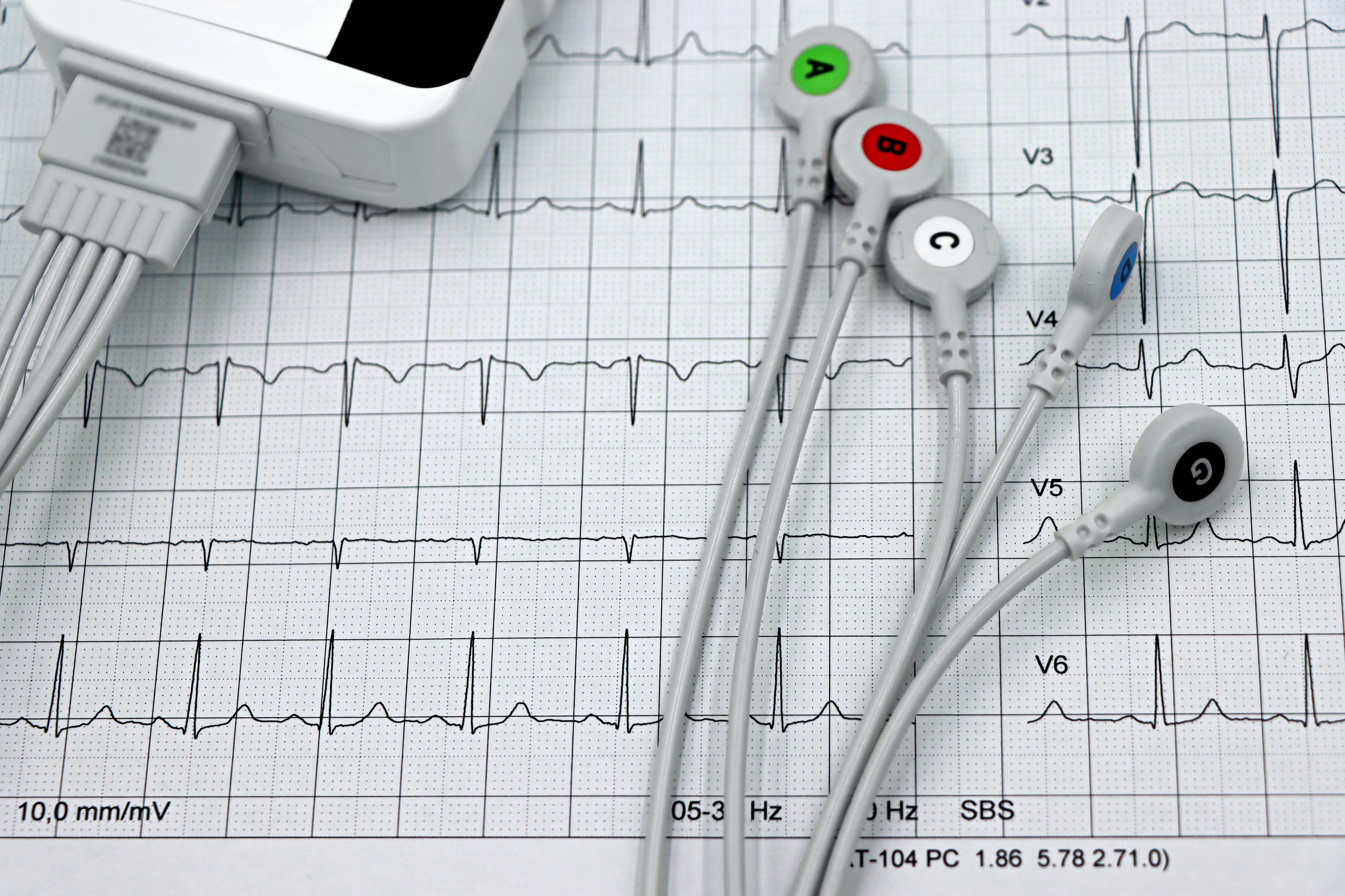 ECG vervolmakingsopleiding voor huisartsen
